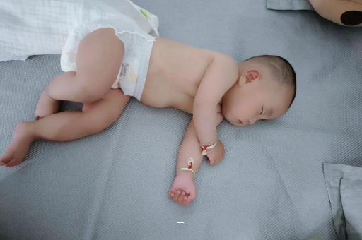 甘南宝宝脸上有白色斑块